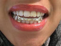 Image result for teeth grillz