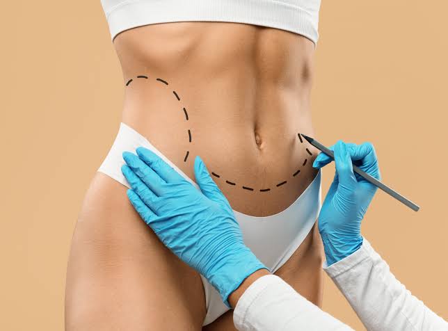 Laser Lipo: Answering Your FAQs - Perfect Doctors Clinic