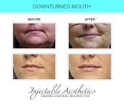 We did not find results for: Treatments Injectable Aesthetics