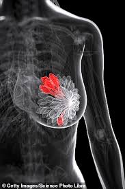This table lists some common side effects of radiation therapy but you are unlikely to experience all of them. Breast Cancer Could Soon Be Beaten In A Week Daily Mail Online