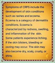 Pin On Complex Regional Pain Syndrome