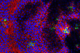 Like Zika West Nile Virus Causes Fetal Brain Damage Death In Mice Washington University School Of Medicine In St Louis
