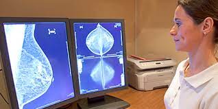 Mammographie Screening Ja Oder Nein Medical Tribune