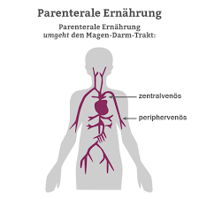 Parenterale Ernahrung Applikation Produkte Pflege De