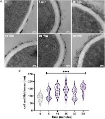 Taking an exam for work or study? Frontiers The Heat Shock Transcription Factor Hsfa Is Essential For Thermotolerance And Regulates Cell Wall Integrity In Aspergillus Fumigatus Microbiology