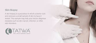 This is the most commonly preferred method of biopsies. Skin Biopsy Tatwa Skin Clinic
