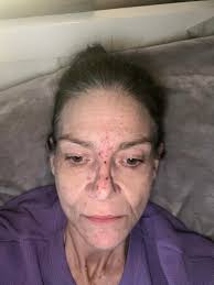 Good Afternoon my fellow SARCOIDOSISIANS, and HAPPY NEW YEAR. It's been  awhile since I've posted so let me get straight to it. Is pain associated  with SARC? Does NAPROX EN work for