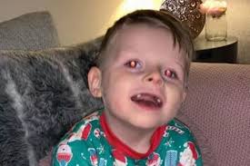 Five-year-old boy in intensive care after suffering 29 seizures in half an  hour