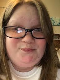 That day felt like it took forever. We were given so much information that  it was hard to wrap our heads around it all. I had my blood taken that day  for