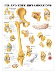 Hip Knee Chart Hip And Knee Inflammations Laminated Lfa 99781