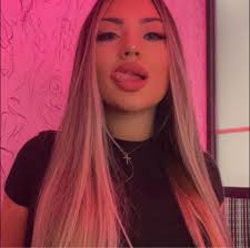 Is it normal for 8 week old puppies to have weird legs?