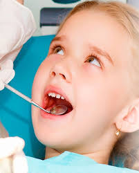 High-Quality Fissure Seals Tranquility Dentistry