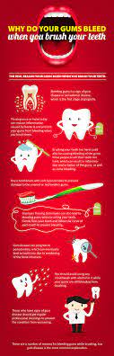This Infographic Talks About Why Your Gums May Bleed When You Brush Your Teeth Provided By Valleydale Dental Dental Dentist Gum Disease