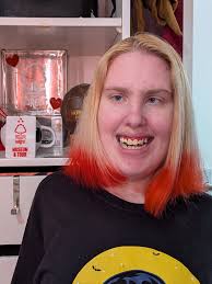 Hey everyone! My name is Melizza, and I'm a 21-year-old from Denmark. I was  born with cerebral palsy, and I'd love to connect with others who have CP  to share experiences, support