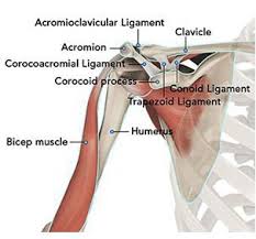 The acromioclavicular joint is where the acromion, part of the shoulder blade (scapula) and the collar bone (clavicle) meet. Standard Anatomic Total Shoulder Replacement Dr Gordon Groh