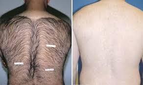 Thomas called me personally to check up on me. Laser Hair Removal Essential Beauty Medical Spa Foothill Ranch Ca