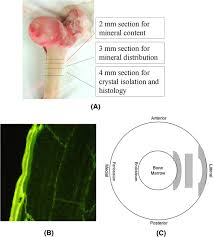 We did not find results for: The Morphology And Lattice Structure Of Bone Crystal After Strontium Treatment In Goats Springerlink