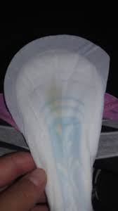 Casi 40 Semanas Y Flujo Transparente Y Amarillo Club De Bebes Febrero 2018 Babycenter