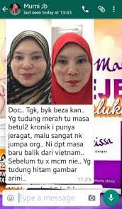 See photos, profile pictures and albums from marissa aesthetic melaka. Rawatan Jeragat Di Marissa Aesthetic