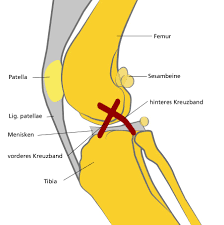 Fit for fun sagt, für wen eine op unumgänglich ist, wie lange der heilungsprozess dauert und wann es auch ohne geht. Kreuzbandriss Beim Hund Artgerecht Tier