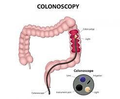 Contact your provider when symptoms. Colorectal Cancer Symptoms Treatment Risk Factors And More