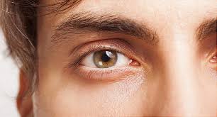 understanding eye allergies itchy eye