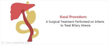 Maybe you would like to learn more about one of these? Biliary Atresia Types Causes Symptoms Diagnosis Treatment Prevention