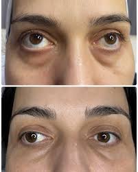 Косметолог Яна Киртока