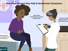 Although depo plays around with your hormones a lot.i lost my hair with my first shot and gain 60lbs in a month and half.so i hate depo. Can Depo Provera Treat Endometriosis