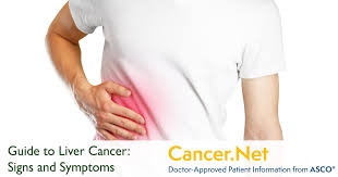 Liver cancer (hepatocellular carcinoma) average cost. Liver Cancer Symptoms And Signs Cancer Net