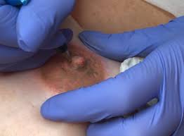 On the more serious side, breast tattoos uplift women who underwent breast operations which left scars and tears. This Tattoo Artist Provides Breast Cancer Survivors With Incredibly Realistic Nipples Vm Med