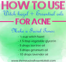 How to use witch hazel for acne. Witch Hazel And Essential Oils For Acne The Miracle Of Essential Oils