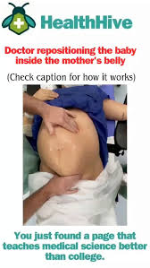 Image result for External Cephalic Version