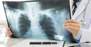 Ct scans are adept at locating pathology in the abdomen or outside of the bowel, says sander r. Chest Imaging What Your Chest Scan Can Reveal Touchstone Imaging Centers