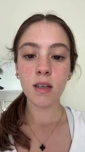 Explosión de Llanta de Petu: Todo lo que Sucedió