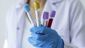 Koronavirüs testi yapan hastaneler hangileri? Tuketiciler Birligi Ozel Hastaneler Korona Testi Icin Ucret Alamaz Yeni Safak