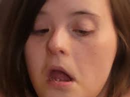 Fundraiser by Amy Thacker Phillips : Help Ashlyn have oral surgery