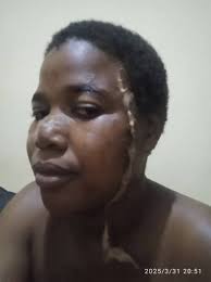 Dzulo anthu awa achekana ndi ma Lazer nkhani zake akuti mabodza. Izi  zachitika ku area 25. Azimayi wandi amvano ndipo anali ma friends koma  adasemphana zichewa nkusiya kucheza. Nde poti amkauzana zinsinsi,