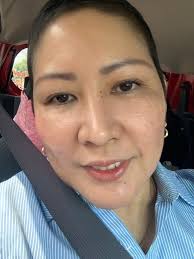 Two months later, her breast ultrasound was Birads 1 and she is feeling  much better.