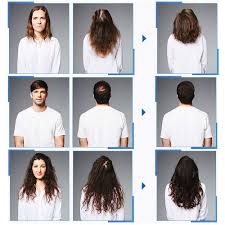 Medications are the most common treatment for hair loss in women. Buy Glemme Biotin Hair Growth Products Kit Microneedle Derma Roller For Scalp Hair Regrowth Men And Women Best Hair Loss Treatment Online In Vietnam B07p5ys2mx