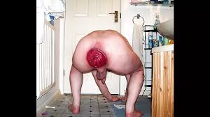 Gay Anal Rosebuds Pride 3 Biggest Prolapsed Rosebuds: Amateur Amateur Porn