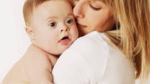 For most people with down syndrome, this anomaly causes a host of. Down Syndrom Enno Ist Ein Wunschkind Buten Un Binnen