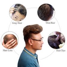 On trend hairstyles hair extensions for men. Buy H Bwig Men Short Toppers Hairpiece Clip In Crown Hair Extensions For Covering White Loss Hair Toupee Ombre Blonde Online In Taiwan B07tzndy3s
