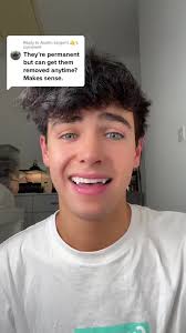 Understanding Temporary Fangs