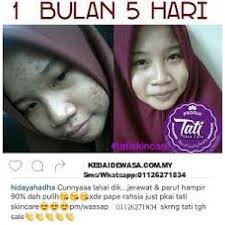 Harga tati skincare baru (1). Tati 5 In 1 Set Harga Borong Murah Original Promosi Testimoni Skincare Malaysia Terlaris