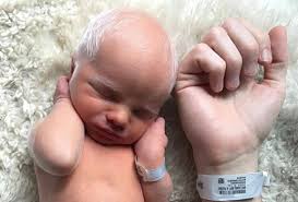 Lift your spirits with funny jokes, trending memes, entertaining gifs, inspiring stories, viral videos, and so much more. How Rare Is Being Born With White Hair