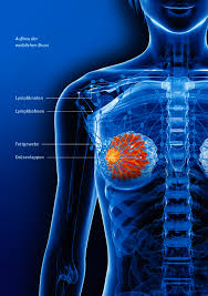 Ein patient verlässt freiwillig entgegen dem handeln gegen ärztlichen rat verweigert ein patient die wollen sie eine entlassung auf eigenen wunsch gegen ärztlichen rat, bitten wir sie auf einem entsprechenden formular um ihre unterschrift. Brustkrebs Deutsche Krebshilfe