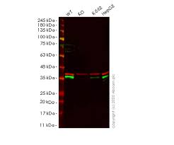 Maybe you would like to learn more about one of these? Anti Pact Pkr Activating Protein Prkra Antibody Ko Tested Ab31967 Abcam