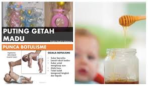 Madu juga masih menyimpan banyak kandungan yang baik untuk tubuh, seperti zat besi, bermacam vitamin, mineral, magnesium dan enzim. Ini Apa Ibu Bapa Perlu Tahu Tentang Penyakit Botulisme