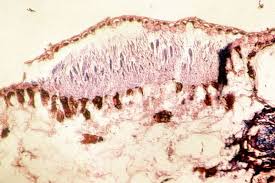 Image result for didymascella thujina